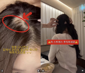 김지민, 정수리 '휑' 충격 공개 