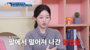 '흑백2' 김시현, 얼굴·팔 '25%' 화상 대참사..."살점들 떨어져 나가" ('옥문아')
