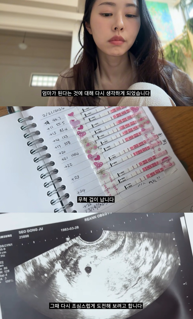 서동주, 계류유산으로 아이 잃었다..시험관 끝 비보 "너무 아파"