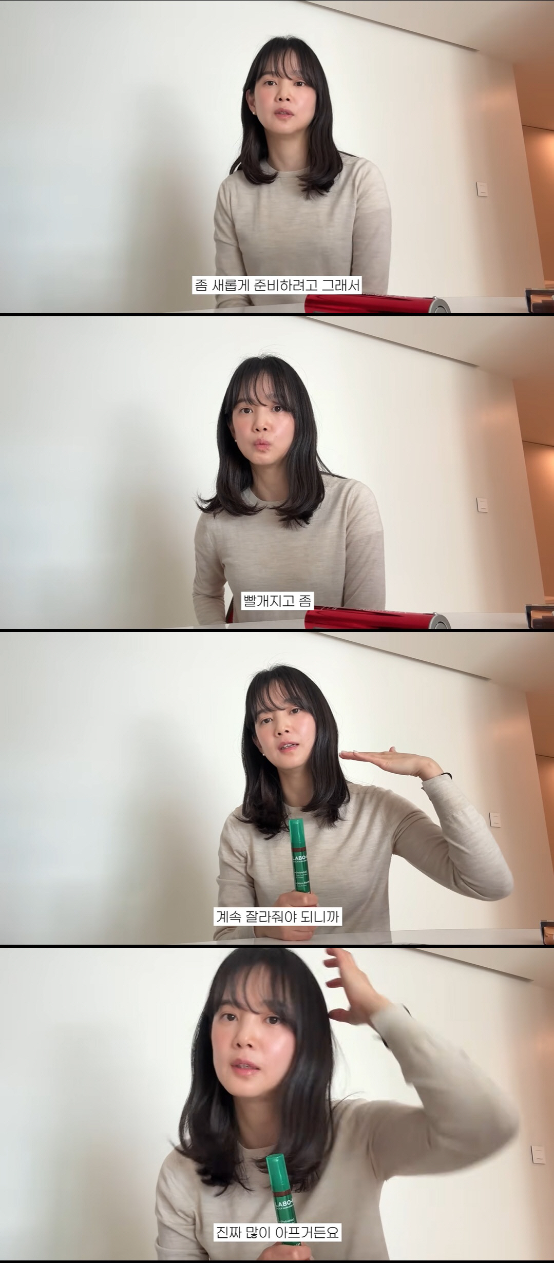 윤승아, 출산 후 탈모만 3년째 "두피 약해져, 머리 길면 더 아파"