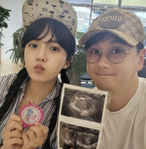 강은비, 유산 아픔 딛고 결혼 1주년...