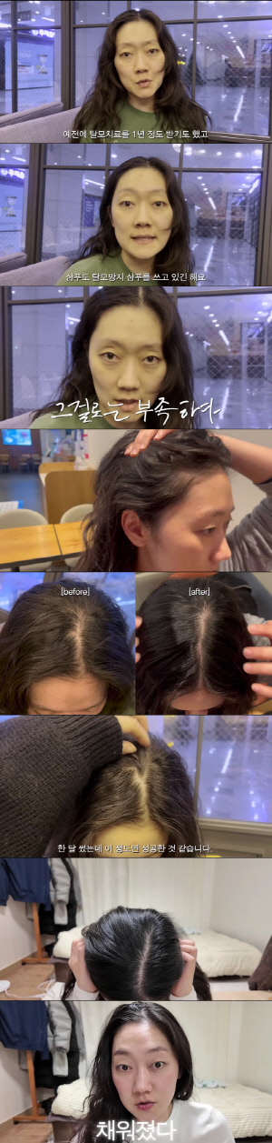 박경혜, 탈모 케어 비포·애프터 공개 