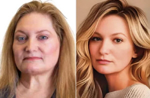 여성 정치인 AI 보정 사진 논란…