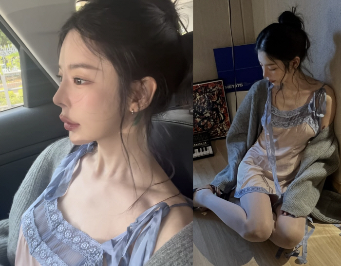 '170cm·48kg' 장재인, 볼살 無·도드라진 흉곽 뼈 '깜짝'..