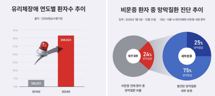 "눈앞에 날파리가, 혹시 비문증?"…14년간 환자 82% 급증