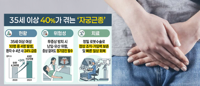 35세 이상 女 5명 중 2명 '자궁근종'…방치 시 난임·유산 가능성