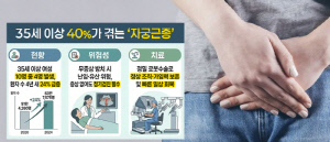 35세 이상 女 5명 중 2명 '자궁근종'…방치 시 난임·유산 가능성