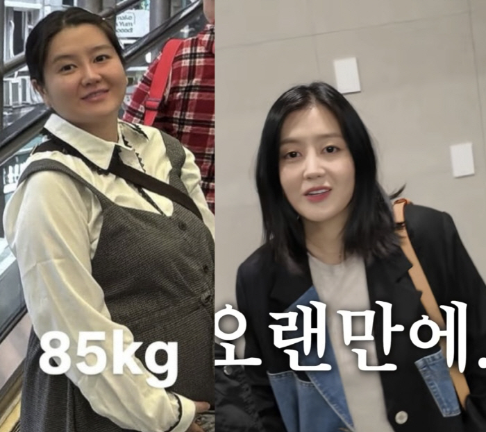 '이용식 딸' 이수민, 30kg 감량 후 뼈말라 됐다 