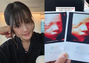 남보라, 29주 아들 입체초음파 공개…'벌써 이목구비 완성' 깜짝