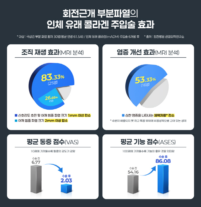 회전근개 부분 파열 '콜라겐 주입' 치료 효과 확인…힘찬병원 "83% 이상, 힘줄 재생"