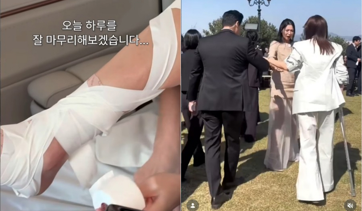 골절된 발목에 직접 붕대 칭칭…엄지원, 목발 짚고 포토월 서며 ‘부상 투혼’