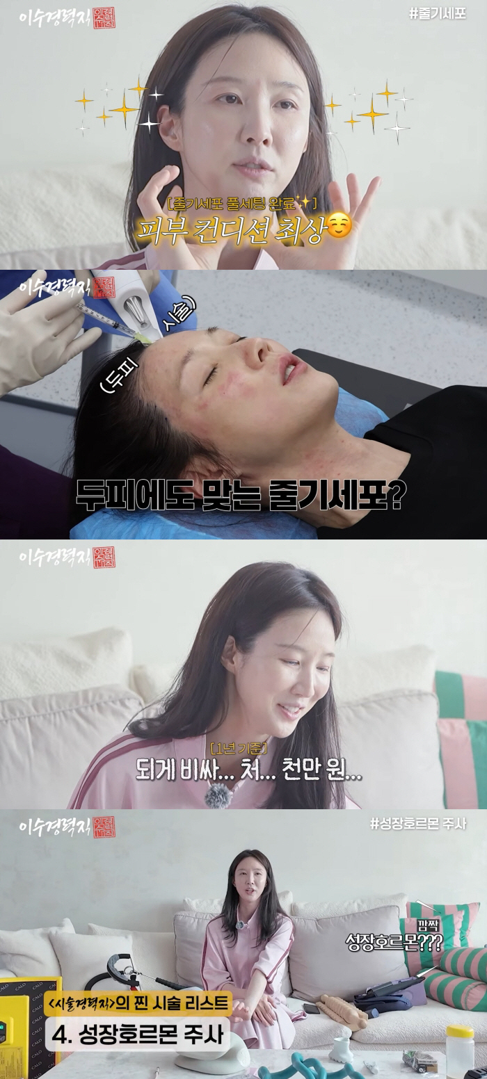 이수경, 1천만 원 들여 줄기세포 시술..성장호르몬 주사까지 '관리 끝판왕'
