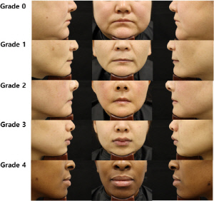 아시아인 입술 볼륨 평가 표준화 제시…'휴메딕스 척도' 개발