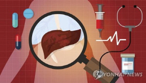 [바이오사이언스] 간암 1차 치료, 생존 2년 벽 넘본다