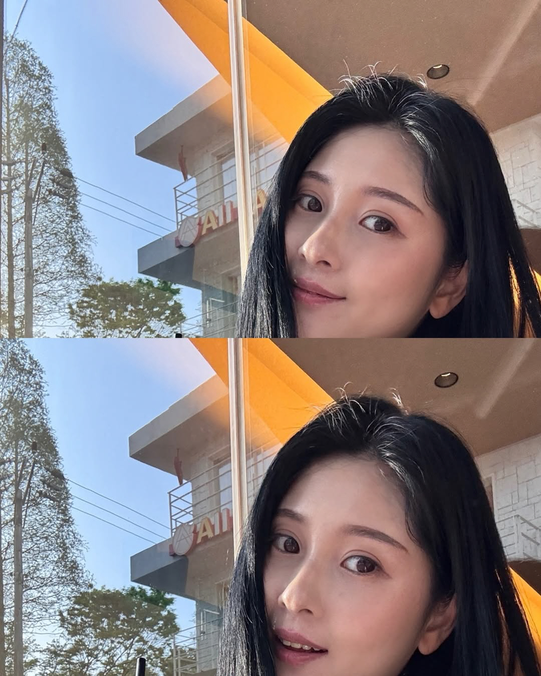 6기 영숙, 갑상선암 수술 후 합병증까지.."총체적 난국" 고통 호소