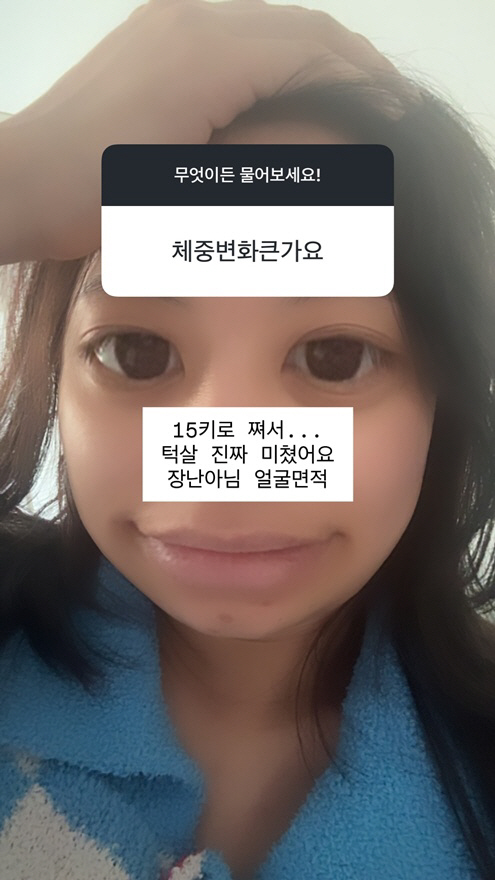 '최현석 딸' 최연수, 임신 후 15kg↑ 확 달라진 얼굴.."턱살 미쳤다" 사진까지 기피