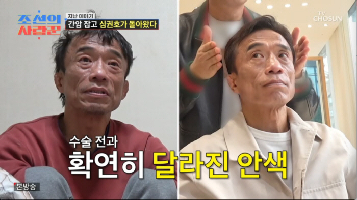 심권호 맞아?...간암 수술 후 못 알아보게 달라진 얼굴→비포·애프터 공개