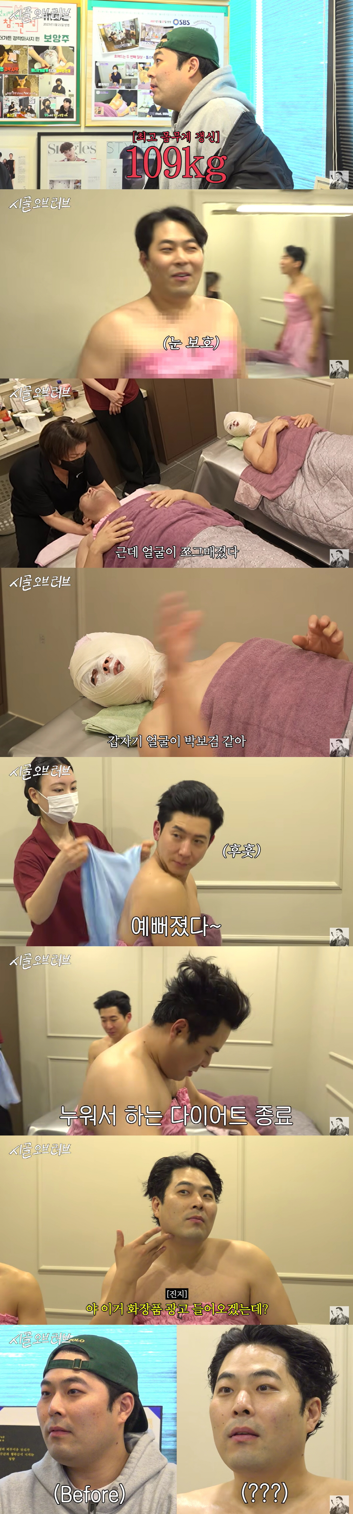 '109kg' 김해준, 경락 비포·애프터에 감탄 "박보검 같아"