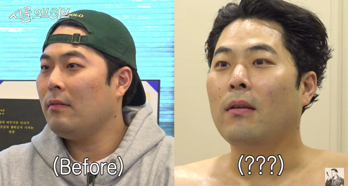 '109kg' 김해준, 경락 비포·애프터에 감탄 "박보검 같아"