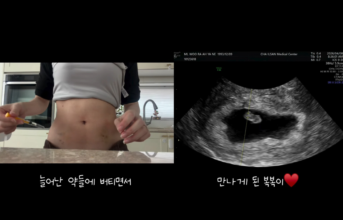 '이지훈♥' 아야네, "유산만 두 번"...눈물 끝에 둘째 임신 "현재 8주"