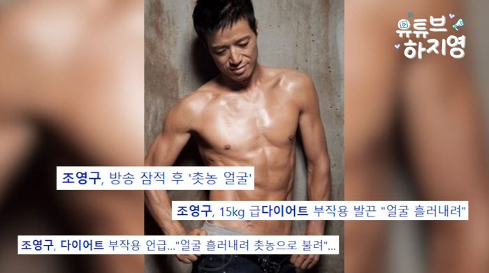 조영구, 15kg 감량 후 ‘촛농 얼굴’ 굴욕 “결국 필러 맞았다”