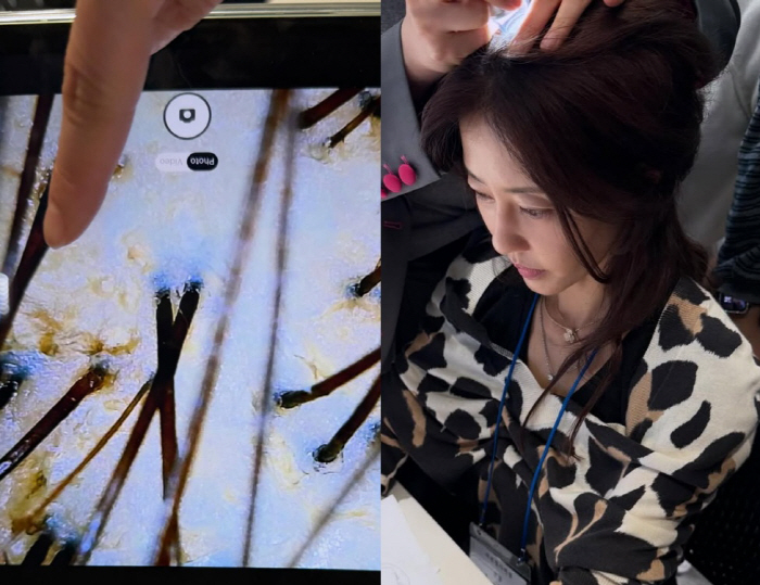 이지현, 생계 위해 미용 공부하다 "기절할 뻔"...두피 상태에 '충격'