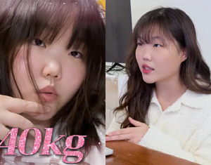 악뮤 이수현, 30kg 급증 후 정신과 진단→40kg 감량 도전 