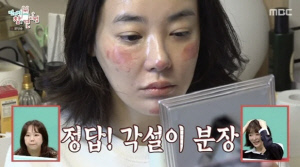 '얼짱 출신' 이주연, 탈모 부은 민낯 충격'..父 "언제 사람 될래?" 탄식