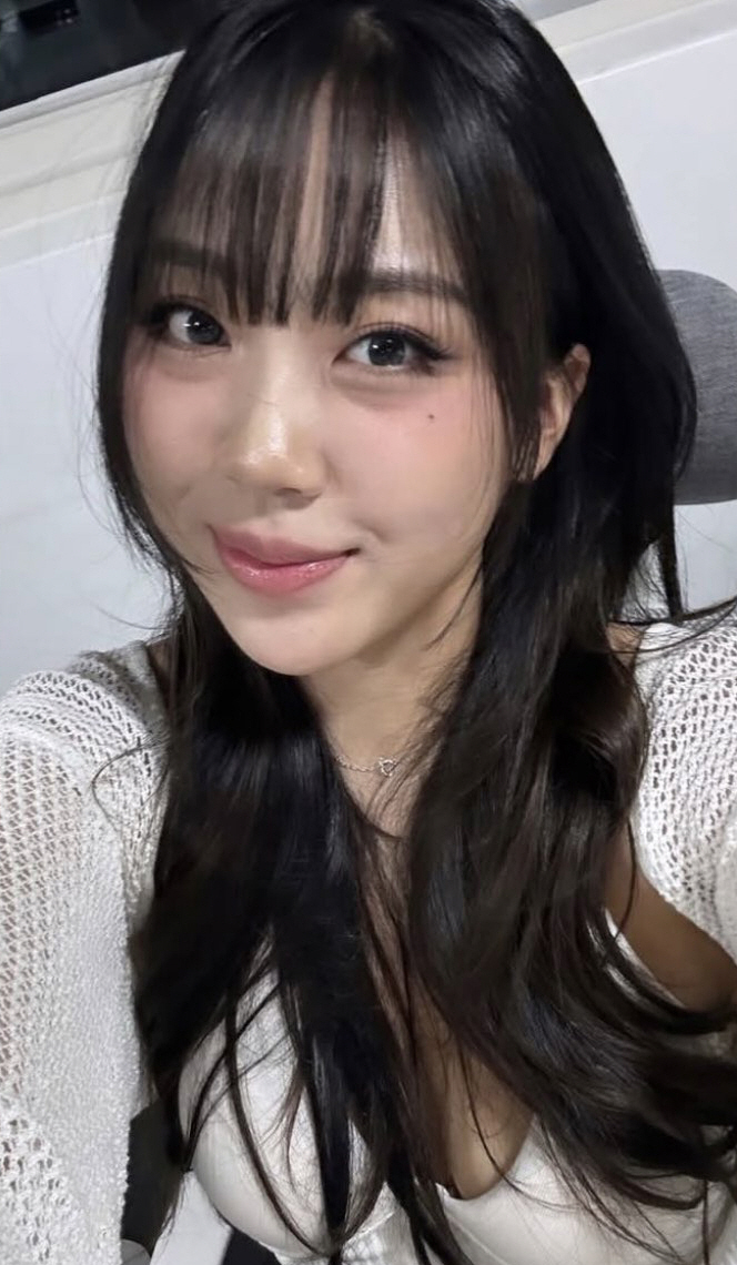 이영지, 눈밑지 후 미모 ‘확’ 달라졌다..“성형 권하는 것 아냐. 처음이자 마지막”