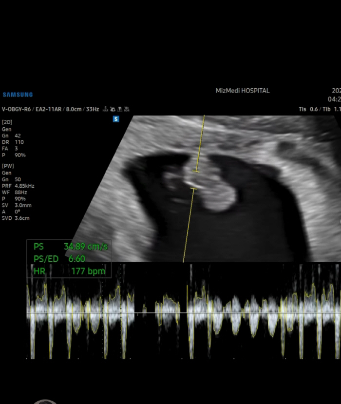아야네, 두 번 유산 후 둘째 임신 8주..."성별 안 중요하다"더니 심경 변화