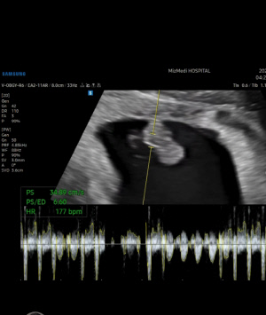 아야네, 두 번 유산 후 둘째 임신 8주..."성별 안 중요하다"더니 심경 변화