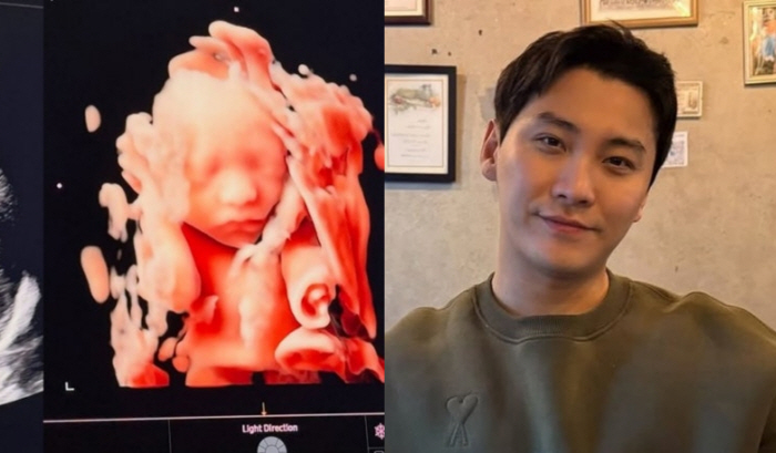 'FT아일랜드' 송승현, 은퇴 후 美서 요식업 하더니 기쁜 소식 “곧 만나자 우리 햇님이"
