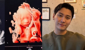 'FT아일랜드' 송승현, 은퇴 후 美서 요식업 하더니 기쁜 소식 “곧 만나자 우리 햇님이