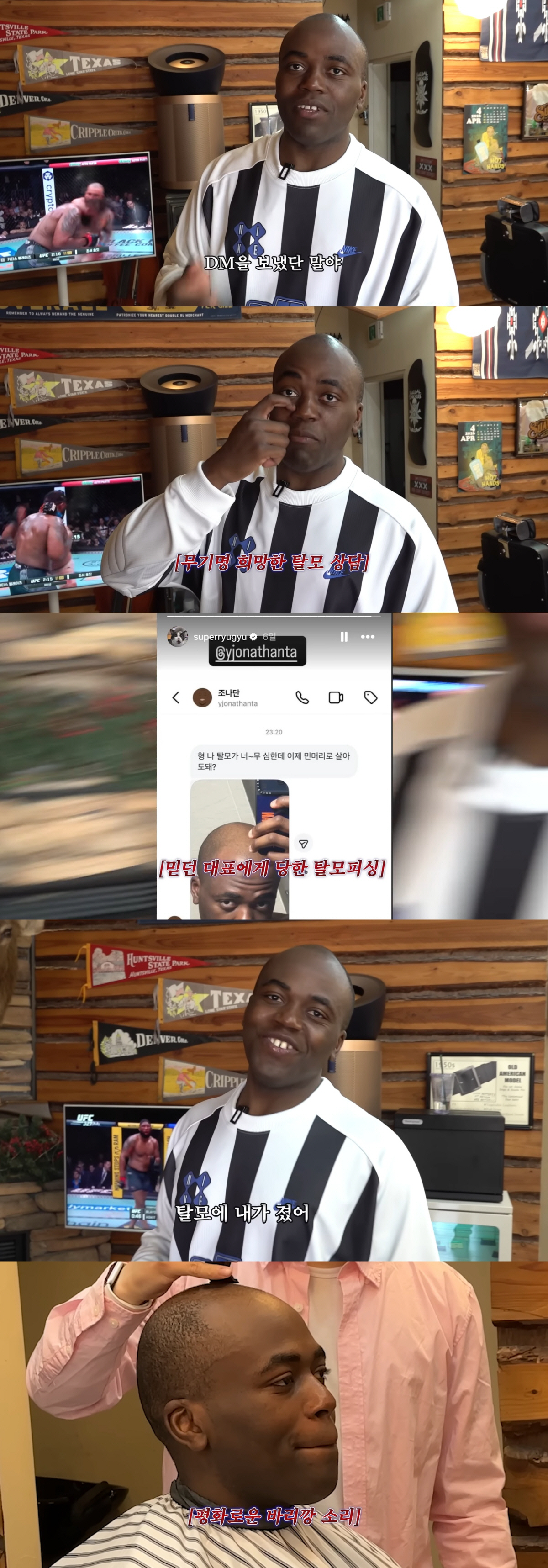 26세 조나단 "회생 불가능, 탈모에 졌다" 결국 삭발...심각한 두피 상태 고백