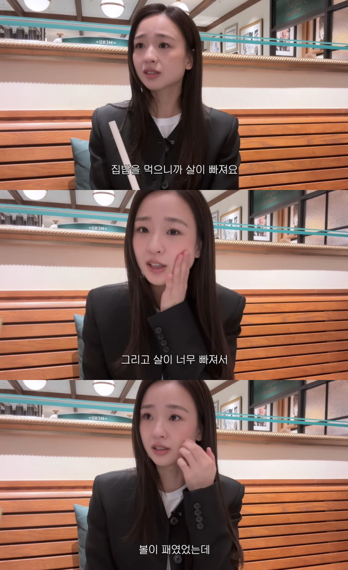 "얼굴 달라졌다" 손연재, 살 너무 빠져서 볼 패였다더니..시술 후 '대만족'