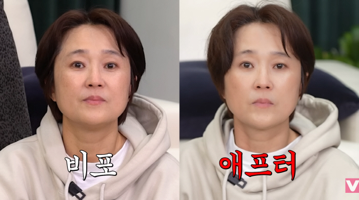 송은이, 조권 괄사 단 3분 효과 "눈 커지고 리프팅"…동안 비결 찾았다