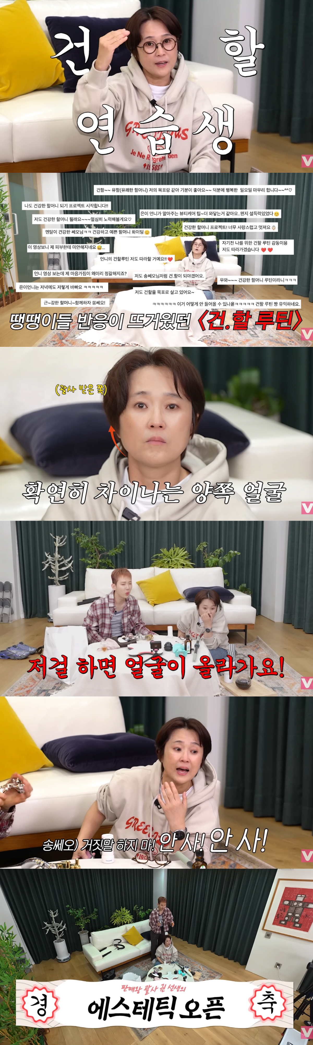 송은이, 조권 괄사 단 3분 효과 "눈 커지고 리프팅"…동안 비결 찾았다