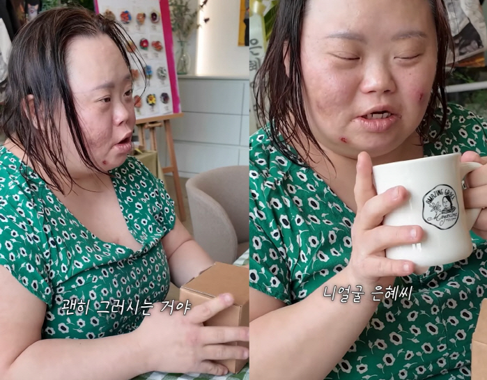 '다운증후군' 정은혜, "왜 제 남편을 혼내요!" 울컥...'발달장애' 조영남 타박에 발끈