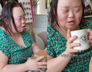 '다운증후군' 정은혜, 