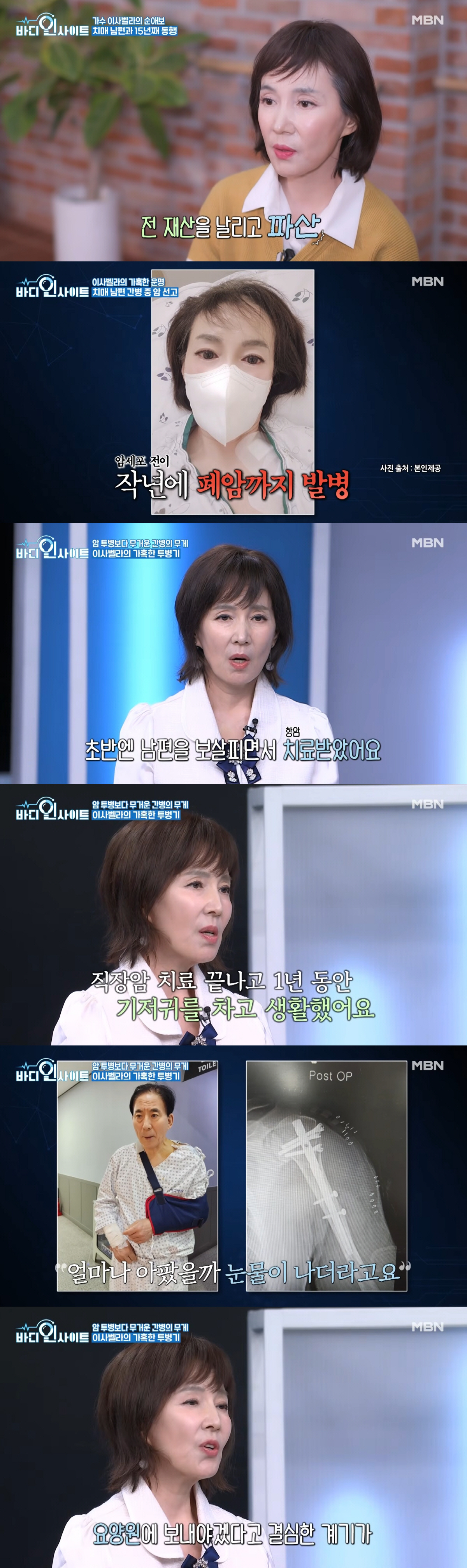 '직장암 4기' 이사벨라 "기저귀 찬 채 치매 남편 간병..결국 요양원 보냈다" ('바디')