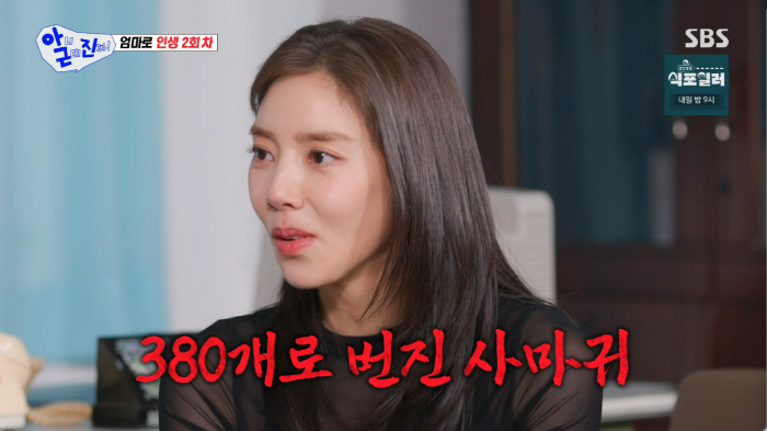 "젊은 엄마 되고싶다" 43세 손담비, 편평사마귀 380개 제거...'과한 관리' 하는 이유 (아니근데진짜)