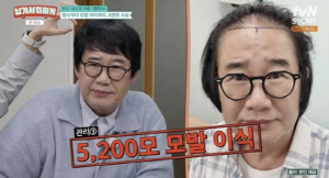 '63세' 최양락, 동안비결 "쌍꺼풀 2번 거상 박피 18번" 충격 수술