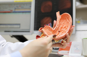 위암 수술 후 재발 2년 내 발생 '최다', 예방법은?