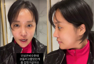 랄랄, '눈밑지' 두 달 만에 부작용 토로 "다크서클 더 잘보여"