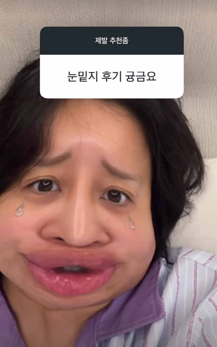 랄랄, '눈밑지' 두 달 만에 부작용 토로 "다크서클 더 잘보여"