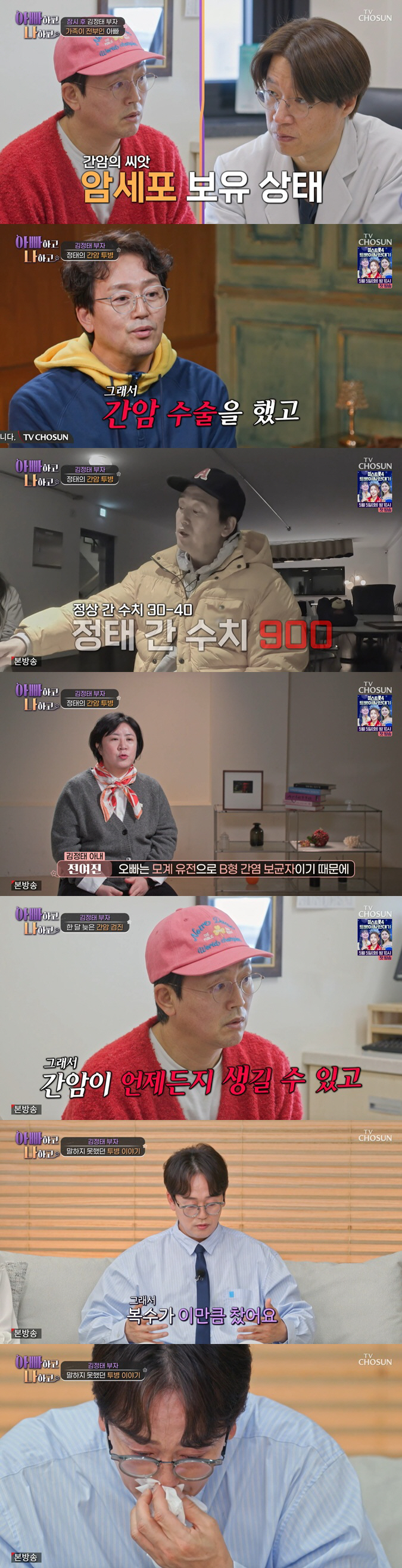 김정태, 간수치 900에 '8시간 대수술'.."배에 복수 찬채 촬영, 잘릴까봐 숨겨"