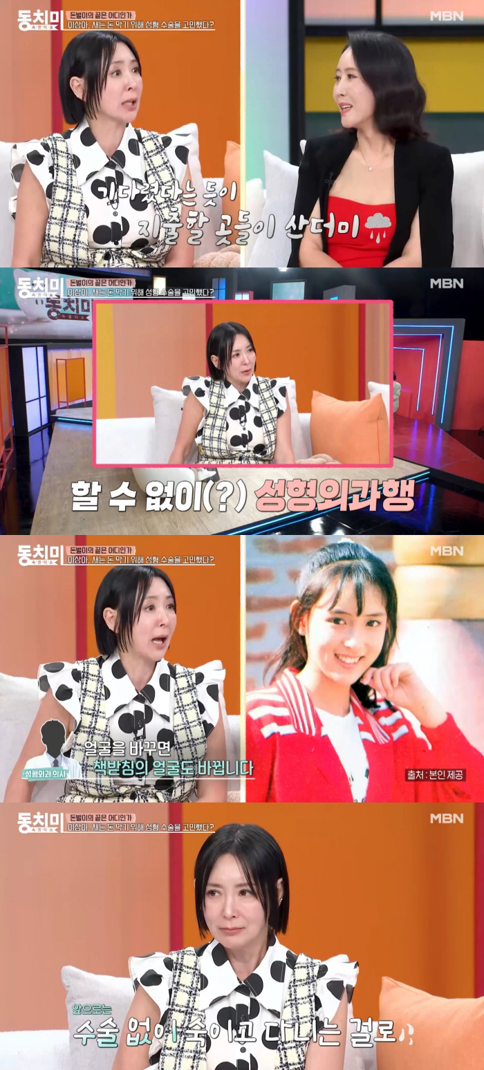 이상아, '돈 새는 관상' 고치러 성형외과 직행..."미용 NO, 돈 막으려고"