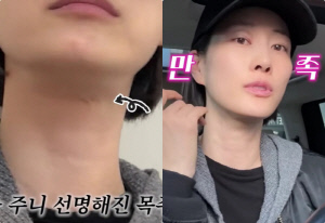 '44세' 이현이, 목주름 시술·보톡스 받았다..확달라진 애프터에 "만족"(워킹맘)