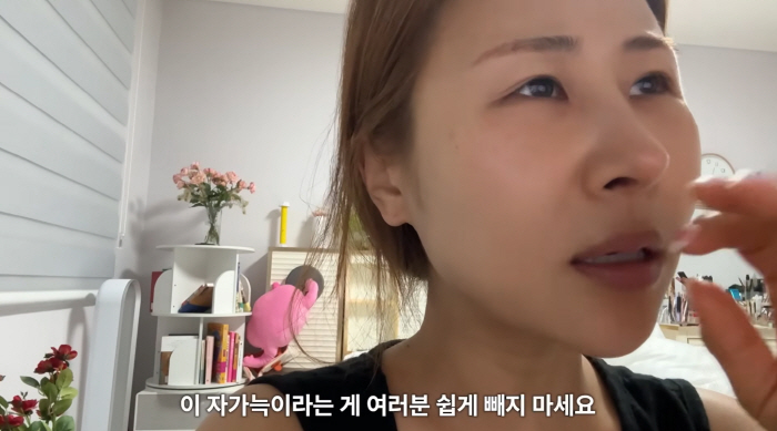 '갈비뼈로 코 성형' 박세미, 불편함 호소.."아직 욱신거려, 수술 신중하게 해야"