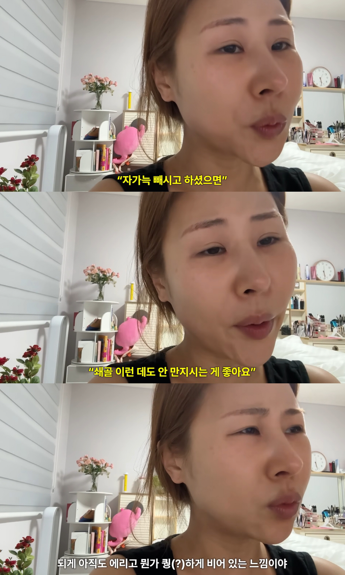 '갈비뼈로 코 성형' 박세미, 불편함 호소.."아직 욱신거려, 수술 신중하게 해야"